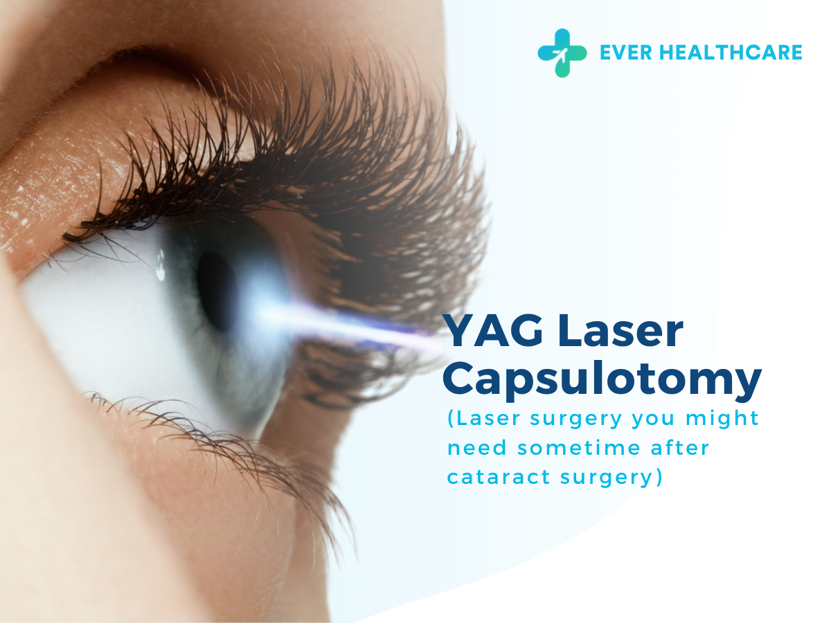 YAG Laser Capsulotomy in Thailand 2023 Compare Price & Reviews Ever